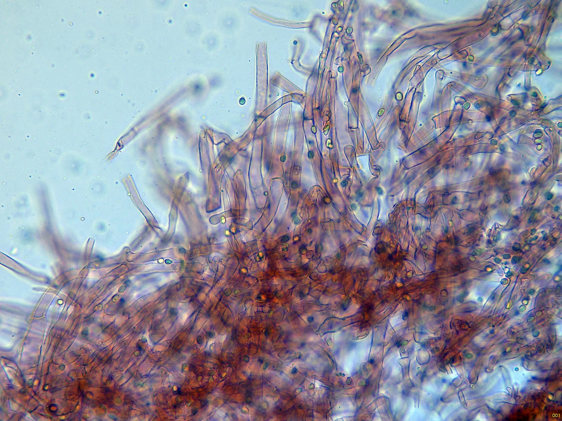 Microscopía de Lyophyllum admissum - 10 - Estipitipellis x 400-001